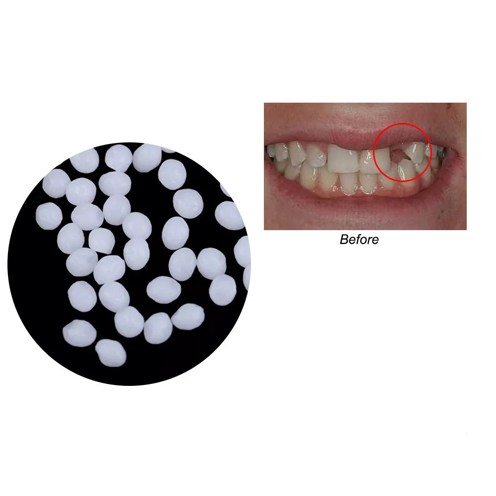 

New Dental Restoration False Teeth Tooth Repair Perfect Smile Veneers Comfort Fit Flex Dentures Paste Braces Adhesives Glue