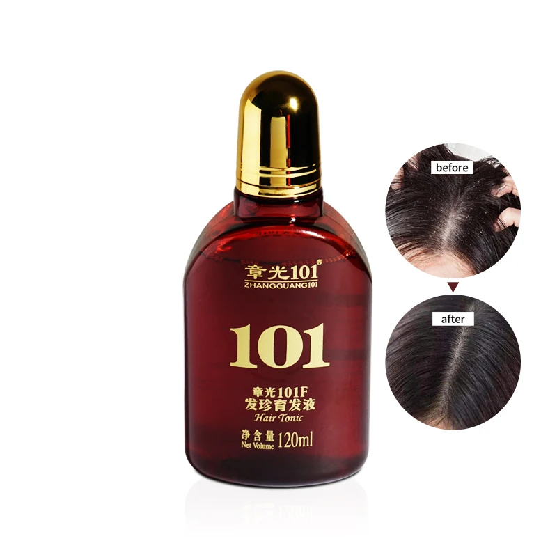 

Zhangguang 101 Natural Formula Nourishing Dry Scalp Treatment Hair Repair Growth Serum