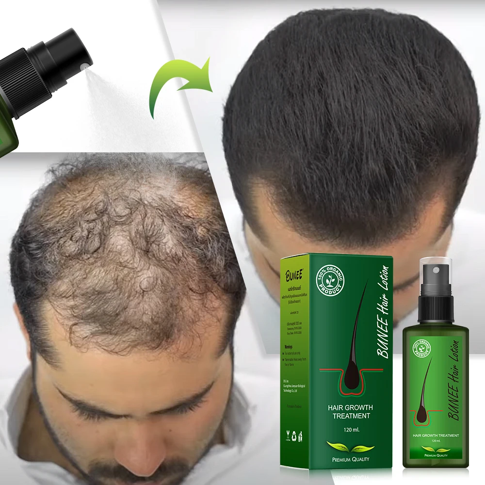 

30ml Hair Loss Treatment Serum Hair Oil Nutrient Solution Organic Biotin Growth Serum Hair Growth Oil