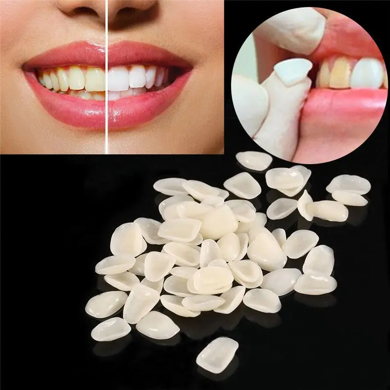 

Dental Disposable Ultra-Thin Whitening Veneers Resin/Dental Ultra-Thin Lower Anterior Shade Whitening veneers, White/yellow