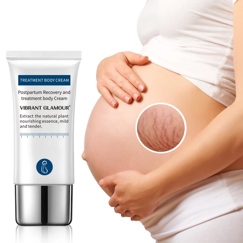 

VIBRANT GLAMOUR Pregnancy Stretch Marks Remover Cream Whiten skin scars Repair stretch marks and remove stretch marks cream