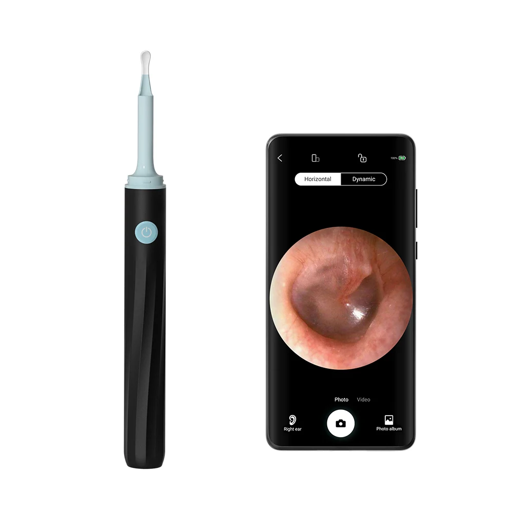 

Spot intelligent digital wireless otoscope WiFi ear-piercing ENT endoscope camera 5.0MP HD endoscope waterproof with 6LED