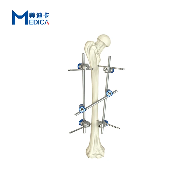 hoffman external fixator orthopedic instruments stryker for radius Surgical fixation set  femoral shaft