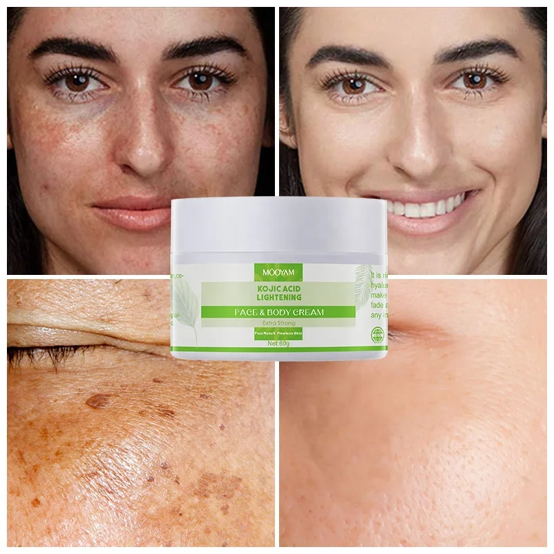 

Kojic Acid Face Cream Anti Aging Wrinkle Beauty Dark Spot Removing Acne Skin Whitening Lightening Face Cream