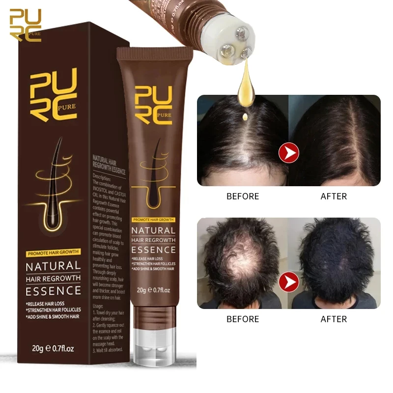 

Wholesale OEM Organic Fast Hair Growth Oil Strengthen Hair Care Serum Repair Follicle Anti Hair Loss Treatment Regrowth Essence