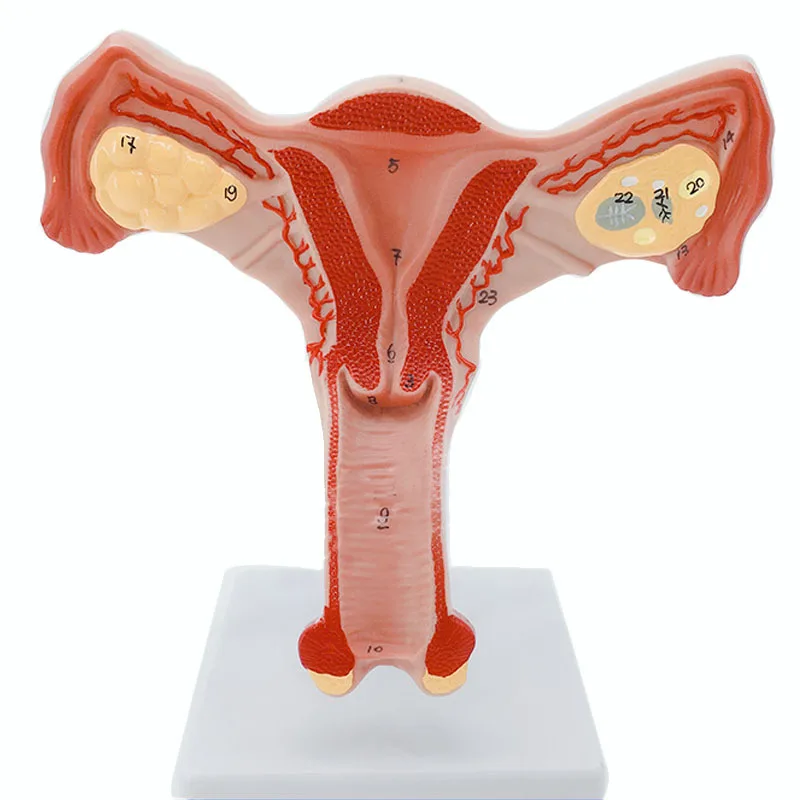 Normal Bilateral Ovarian Uterus Medical Teaching Education Model