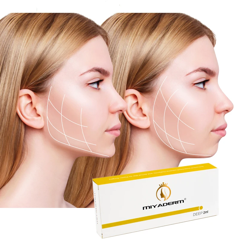 

filler acid hyaluronic injections acido hialuronico filler