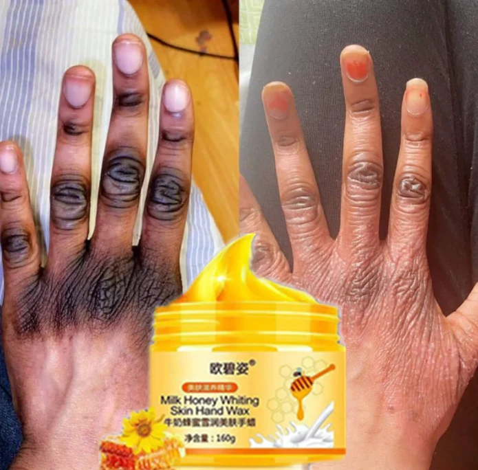 

OEM peeling Body lotion Skin Smooth Regenerated Natural Whitening Yellow Peeling Oil extra strength body to remove SKIN layer