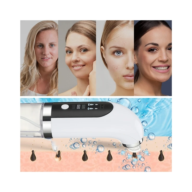 

Factory Direct Supply Stainless Steel Face Vaccum Beauty Vacuum Pore Cleaner With Camera Blackhead Remover, White