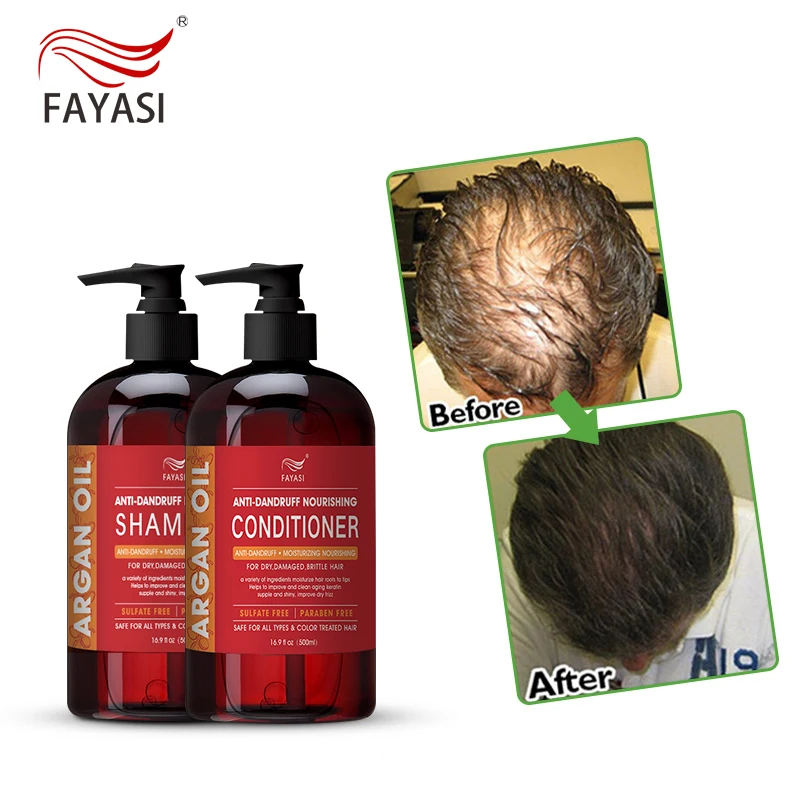 

Factory direct supply argan oil shampoo morocco hair treament shampoo