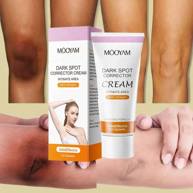 

Private Part Whitening Cream Snow Bleach Cream Intimate Underarms Bikini Area Remove Dark Spots Inner Thigh Whitening Cream