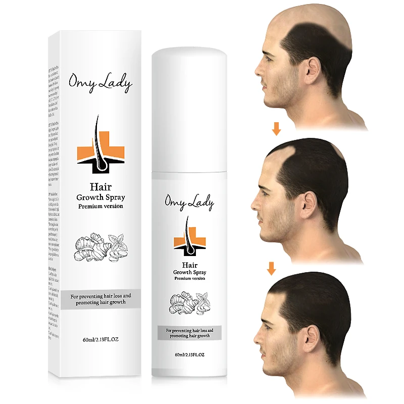 

OMY LADY magic hair growth tonic ginseng best hair loss treatment for men