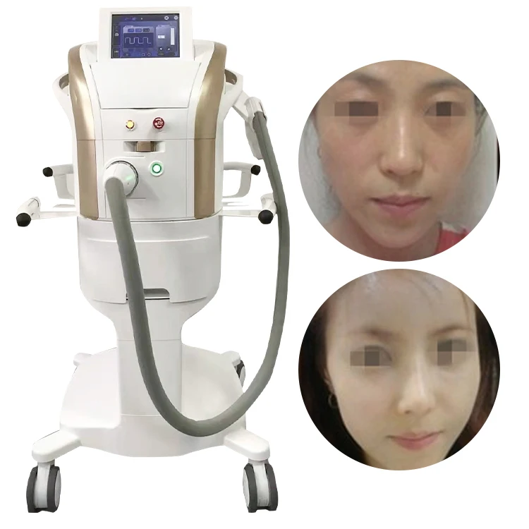 

Hot selling M22 Laser Acne Treatment M22 Ipl Hair Removal M22 Opt Skin Rejuvenation machine for spa use