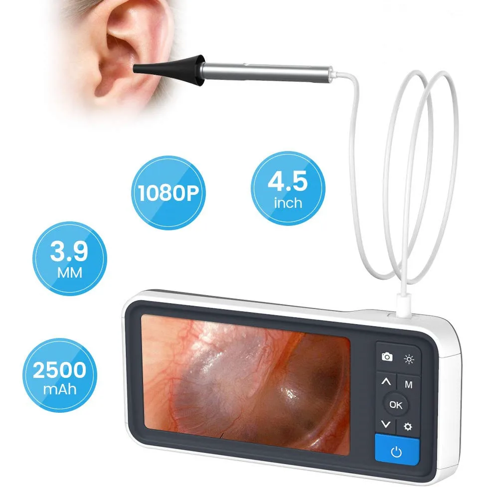 3 In 1ear Endoscope Camera 3.9mm Medical Endoscope Camera Ear Nasal Endoscope Usb Otoscope Buy