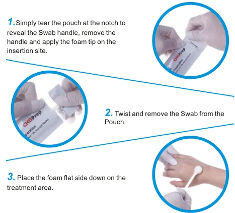 CHG skin prep swab.jpg