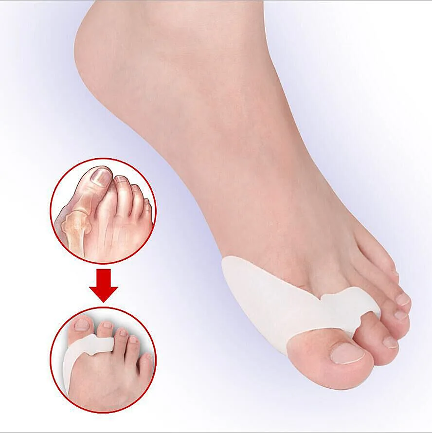 

Double Loops Bunion Corrector Daily Life Foot Care Gel Toe Separator, Skin and white