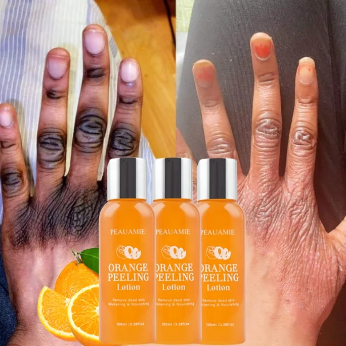 

Free Sample Whitening Oil Body Care Orange Peeling Lotion Exfoliating Yellow Peeling Oil For Black Skin