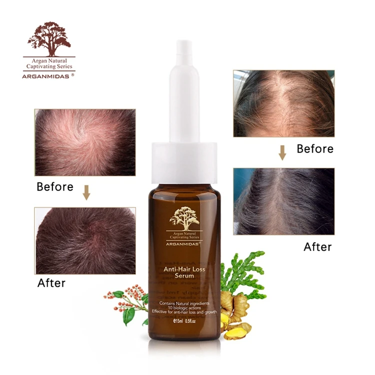 

OEM Private Label Natural Anti Hair Loss Products Organic Ginger Hair Growth Serum Hair Oil