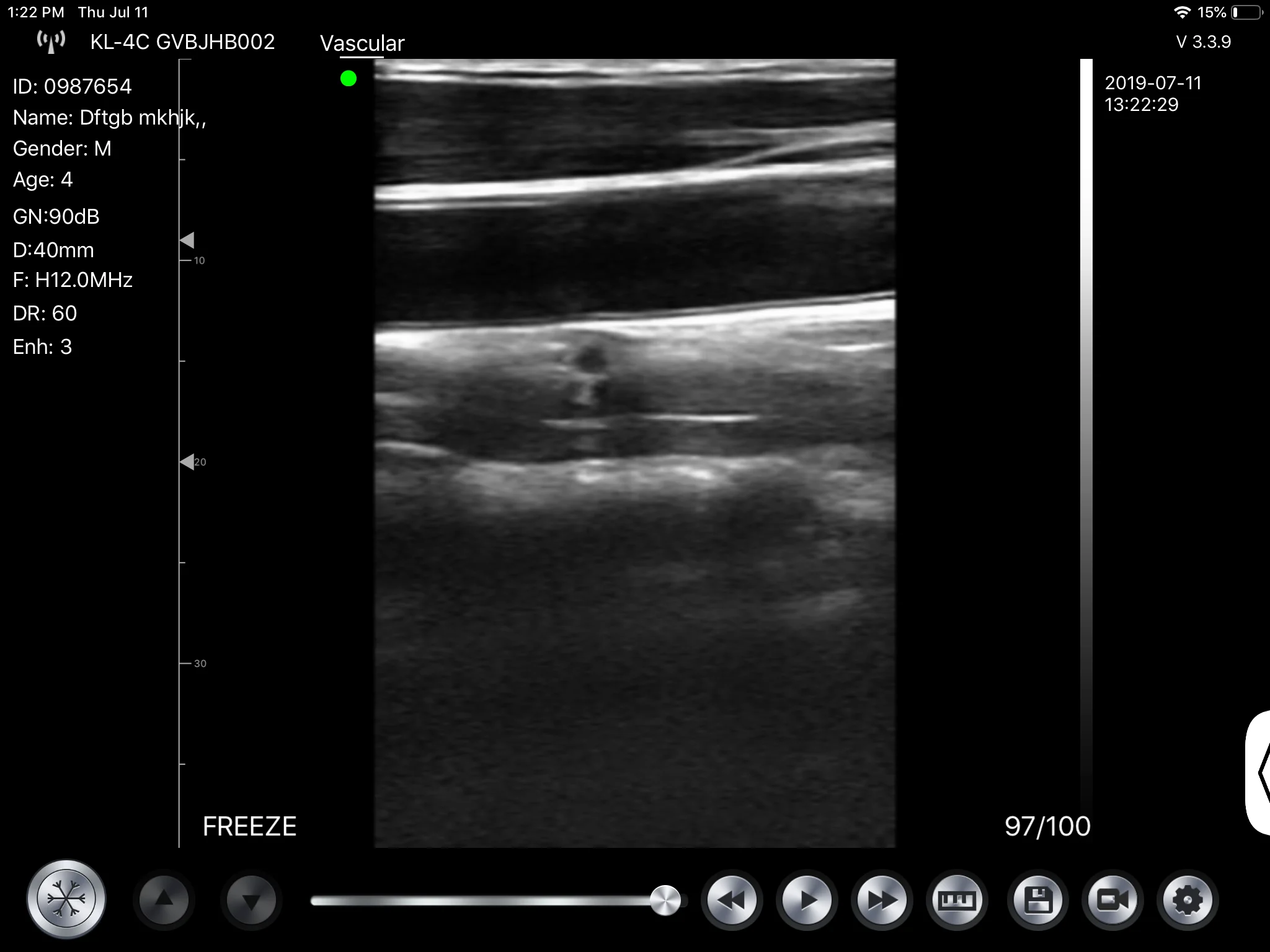 
2019 Konted digital portable wireless ultrasound 10/12MHz linear probe Gen4pro for clinical emergency 