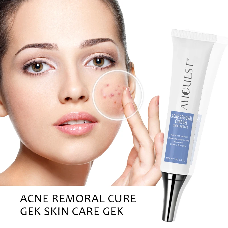 

AUQUEST Hot Sale Acne Remvoal Skin Whitening Cream Anti Acne Cream Acne Treatment Moisturizing Lotion, White