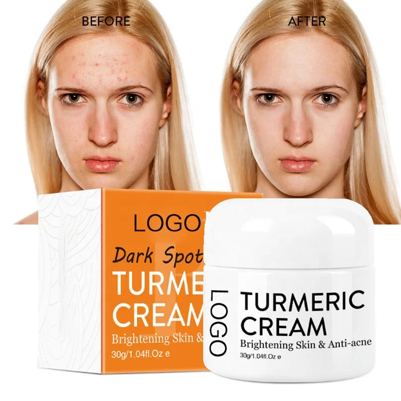 

30g Skin Care Face Lightening Whitening Organic Tumeric Facial Cream Whitening Cream