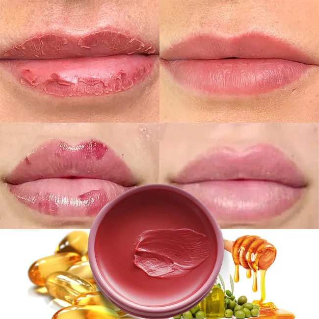 

custom herbal lip lightening cream for dark lipsvitamin e anti crack whitening cherry lips cream gelpink lip gloss balm