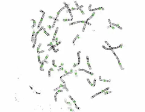 
SH Chromosome Auto Karyotyping Image System 