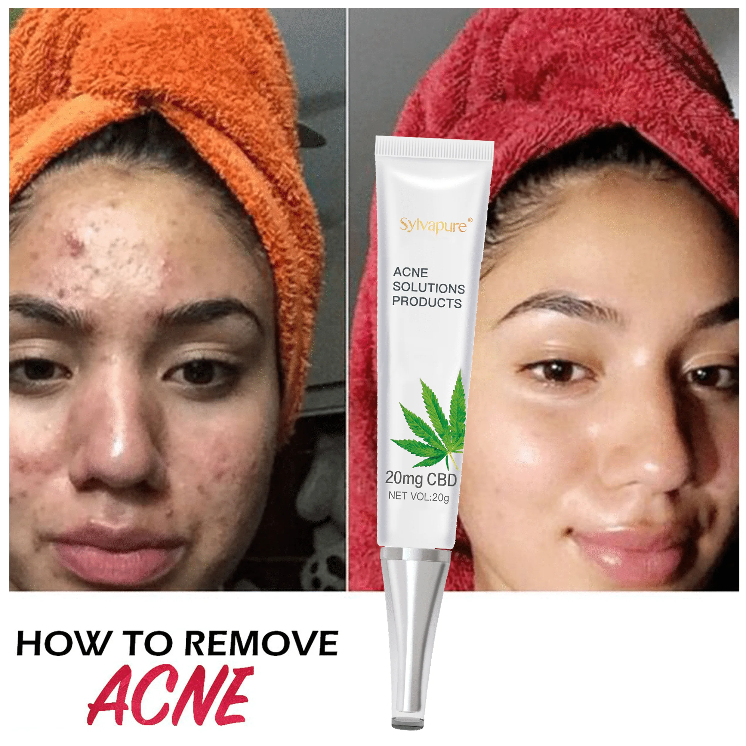 

Scar Cream 30g Acne Treatment Blackhead Removal Acne Cream Oil Control Shrink Pores Acne Scar Remove CBD Cream