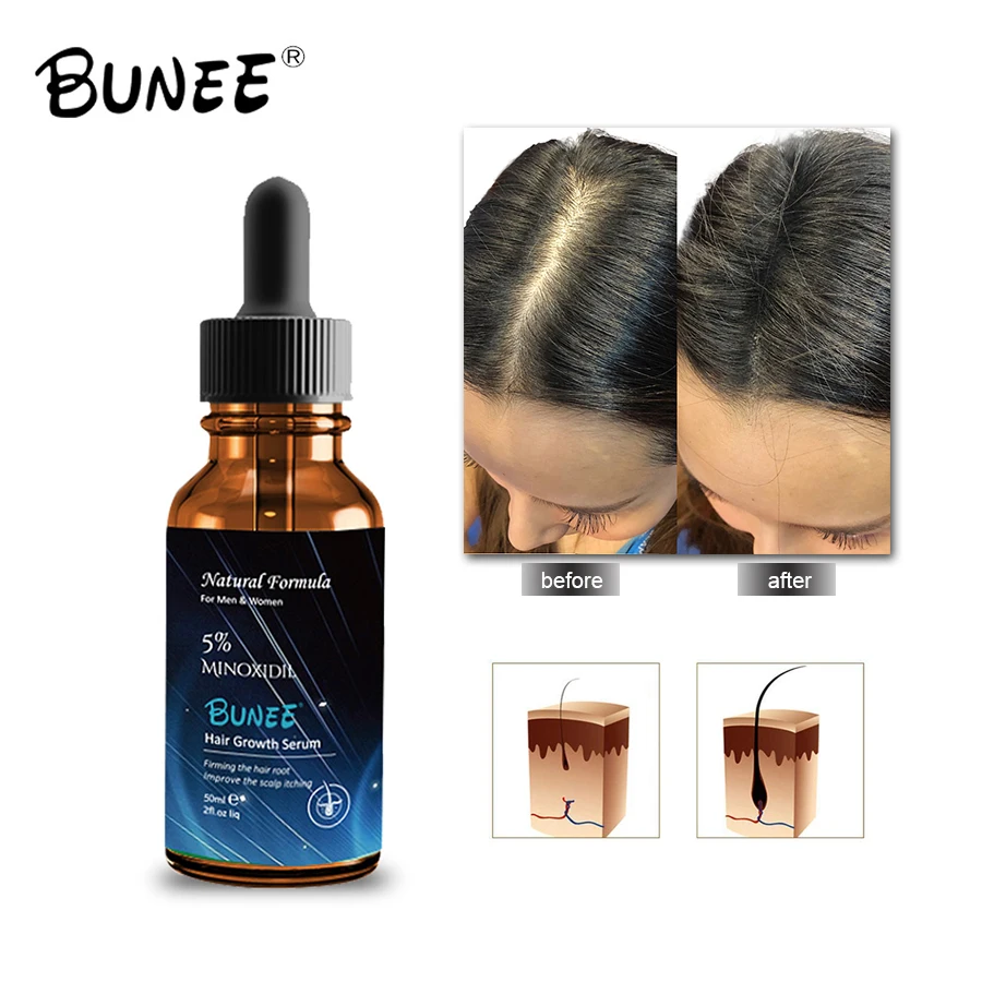 

50 ML BUNEE OEM Private Label Customized Hair Growth Serum for Hair Baldness