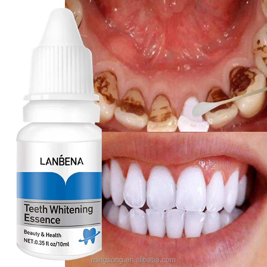 

Teeth Whitening Liquid to remove black teeth, yellow teeth, smoke teeth
