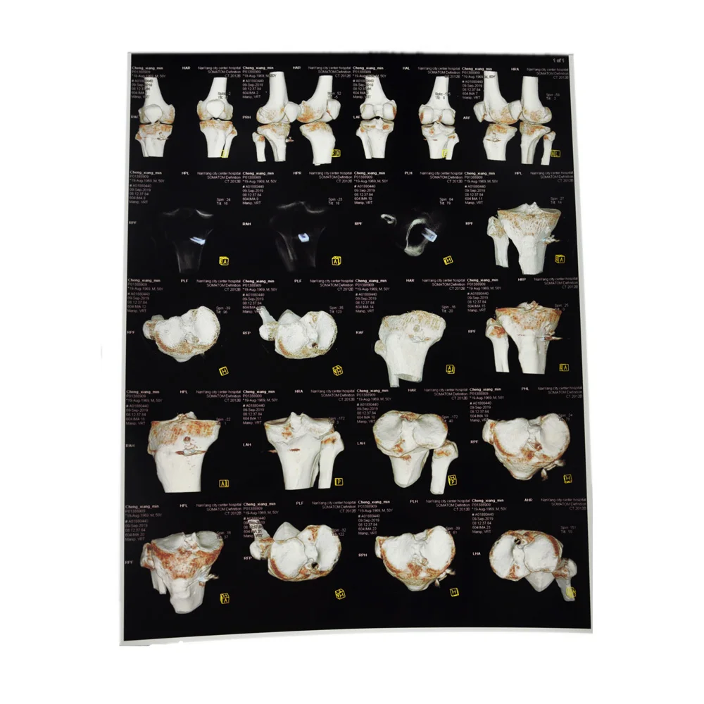 farmasino x光胶片宠物基白色医用干膜x光胶片价格 - buy medical dry