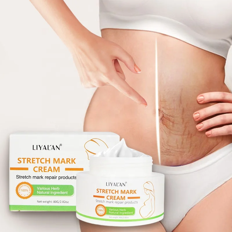 

High Effect Maternity Skin Care Scar Stretch Marks Removal Cream Remove Pregnancy Stretch Mark Cream