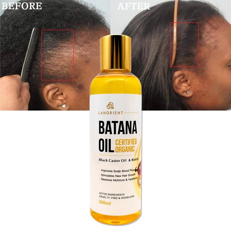 2026 Best-Selling Natural Organic Castor Batana Hair Growth Oil with 2-IN-1 Formula for Moisturizing Nourishing Refreshing Hair