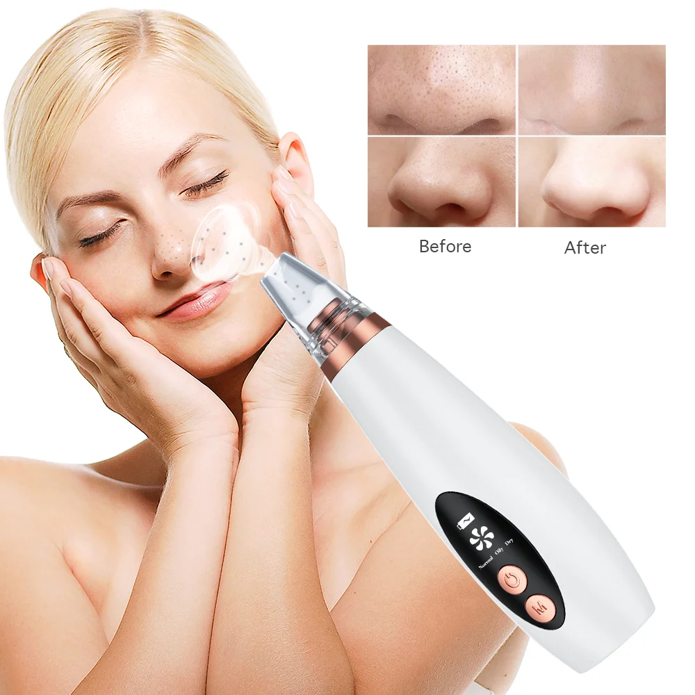 

Portable electronic deep cleansing facial skin care tool kit acne pimple nose suction blackhead remover vacuum, White/customized