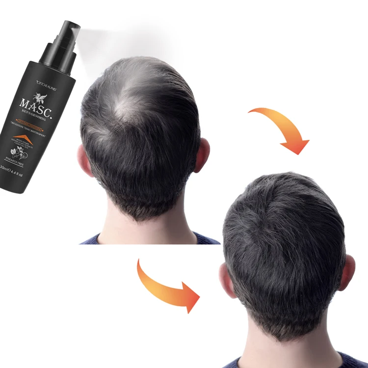 

OTTO KAUNIS MASC Biotin Vitamin E Anti Hair Loss Tonic