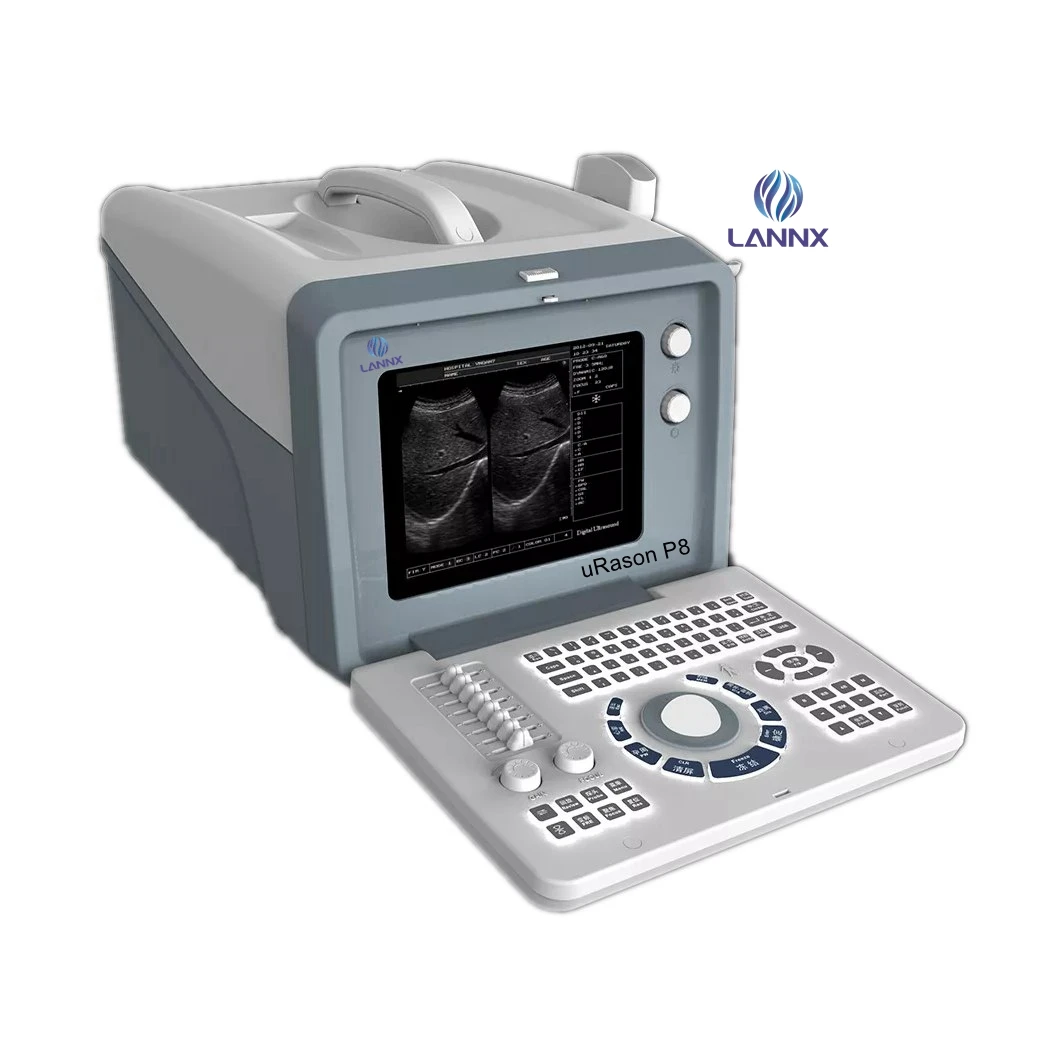 

LANNX uRason P8 Cheap price full digital Portable ultrasound machine scanner LED Full Digital ultrasound System ecografo