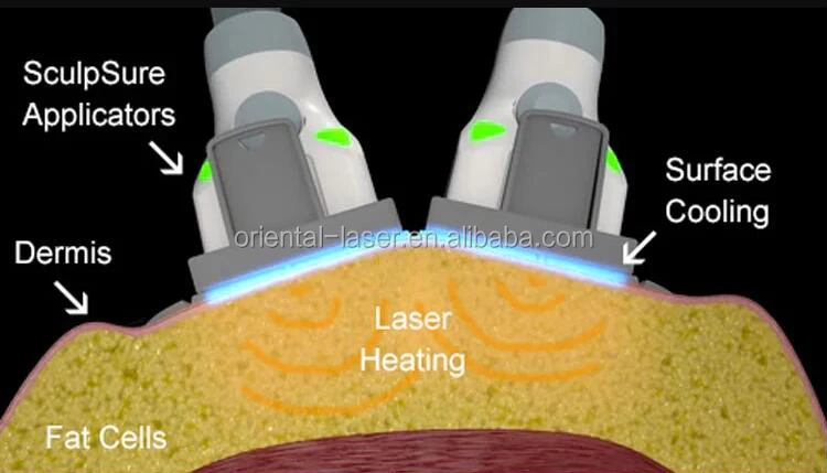  1060 diode laser slimming machine.jpg