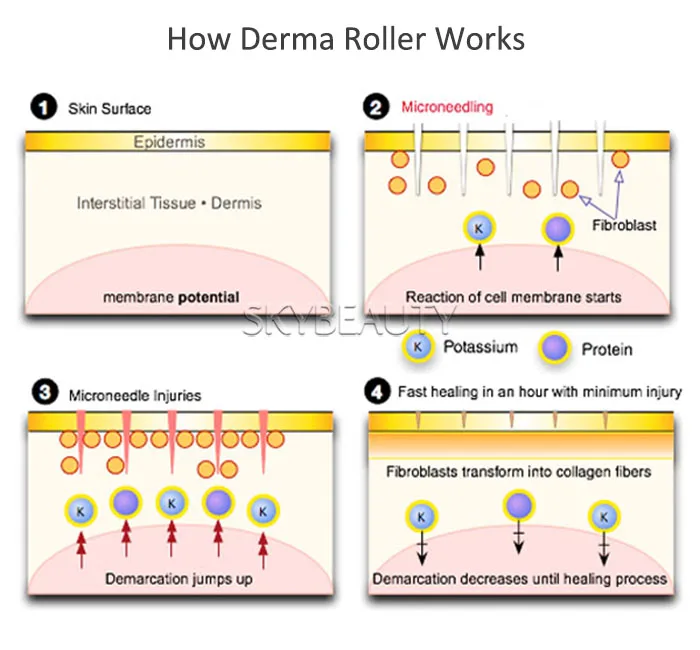 How Derma Roller Works.jpg