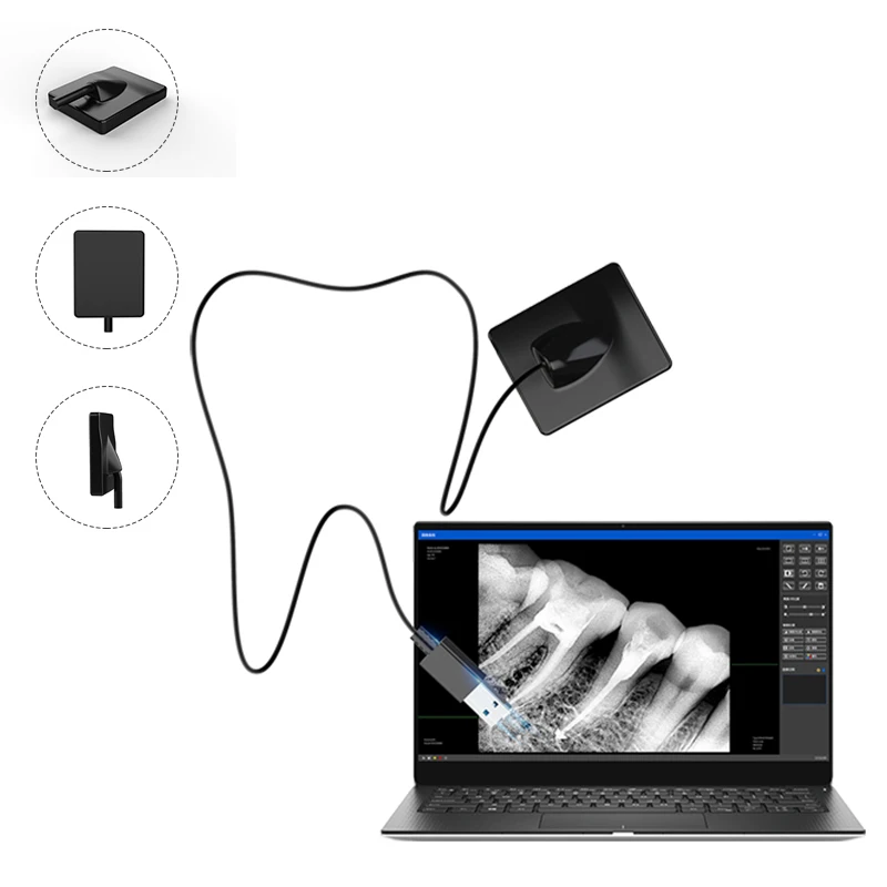 

Factory Price Medical Digital Dental X ray Intraoral Clinic X-ray Sensor