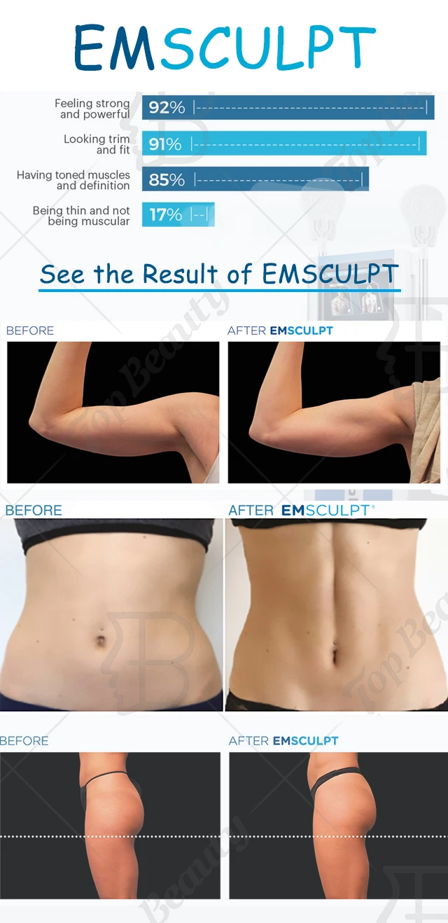 Emsculpt аппарат отзывы до и после Новое Устройство Для Снижения Жира Электромагнитная Энергия Abs Тонизирование И 