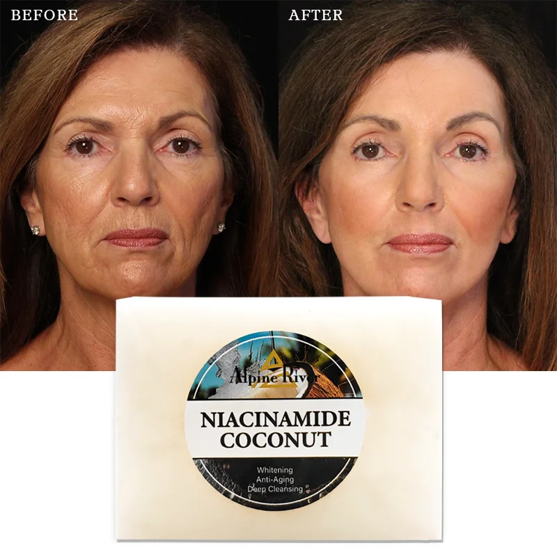 200g Natural Organic Skin Whitening Deep Cleansing and Exfoliating Niacinamide Coconut Whitening Soap for Glowing Skin