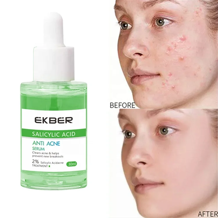 

OEM High Quality Glycolic Acid Korea Facial Anti Acne Repair Skin Care Anti Acne Serum