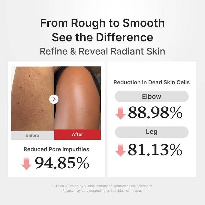 Transformation Results Body