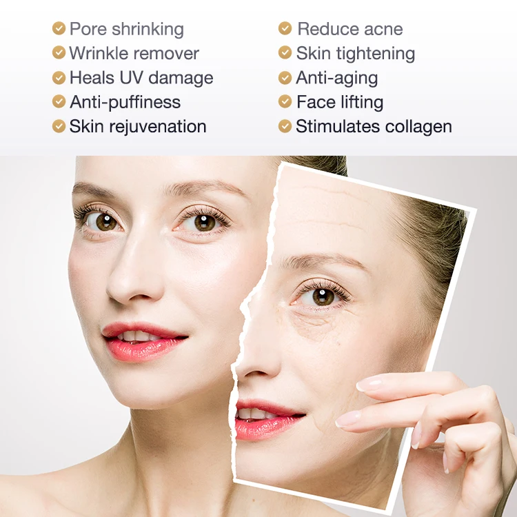 
Comper Smarkin Home Use Beauty Device Face Lifting Acne Treatment Skin Rejuvenation Wrinkle Remover 