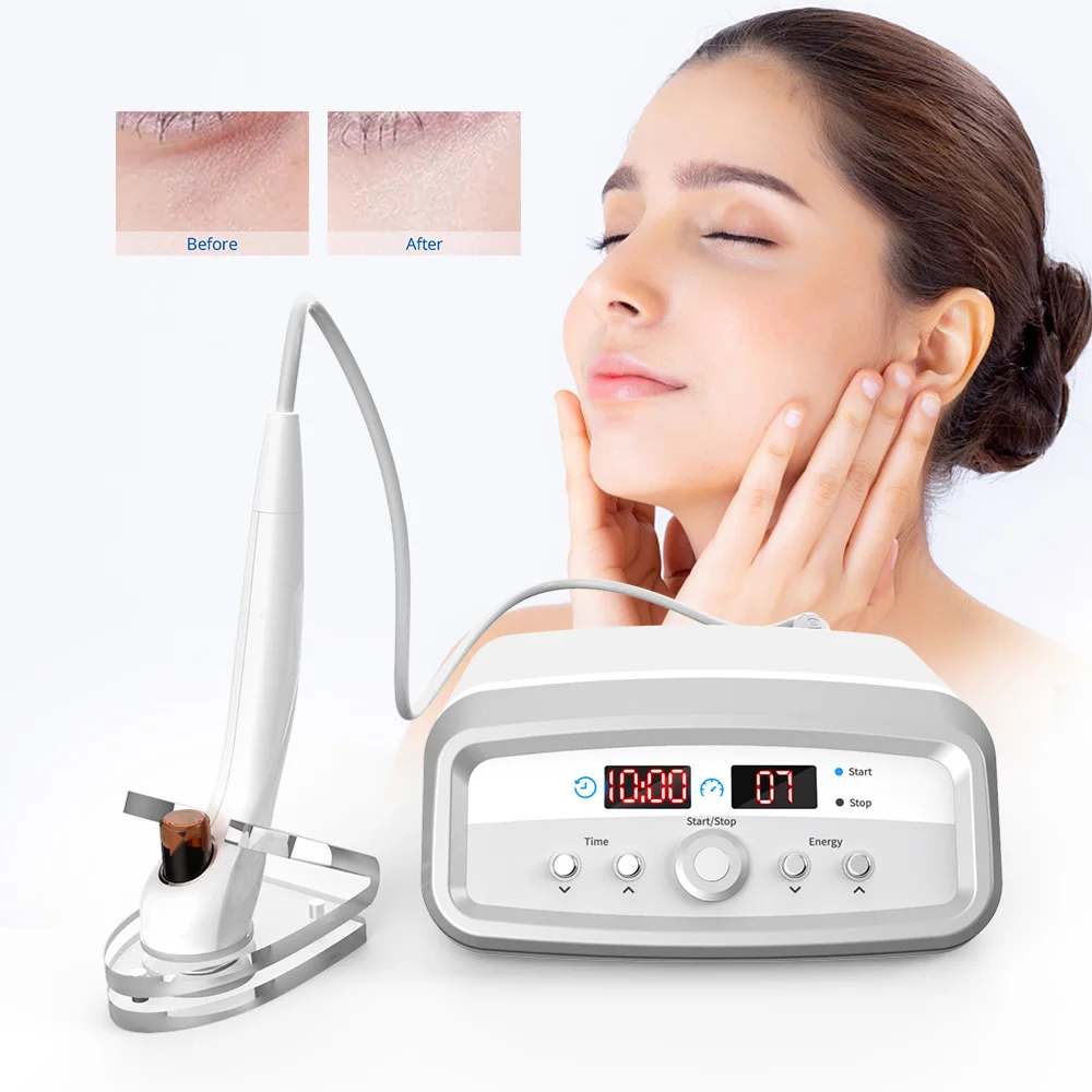 

non-surgical Mini RF Faical skin care Anti-aging Device US free shipping