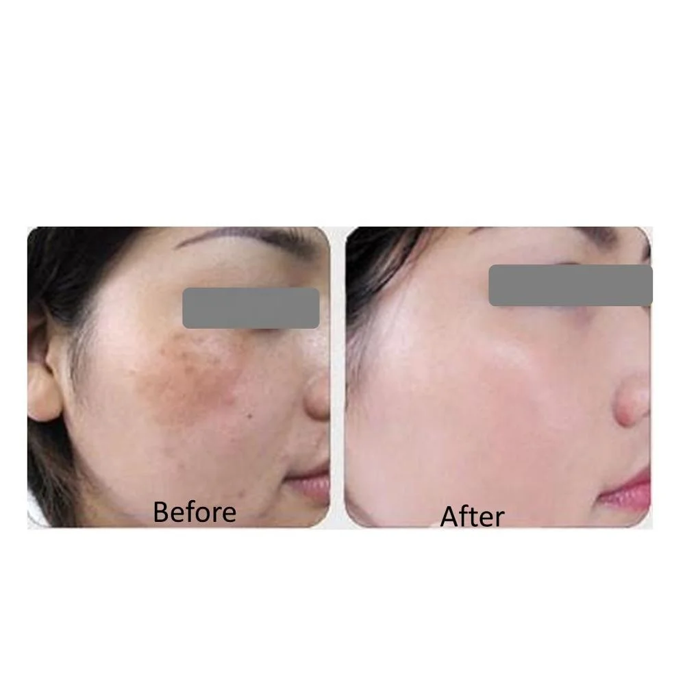 
OEM hyaluronic acid serum for brightening Vitamin C serum 