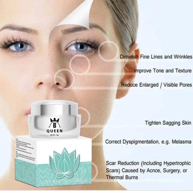 Anti-Acne Cream 8.jpg