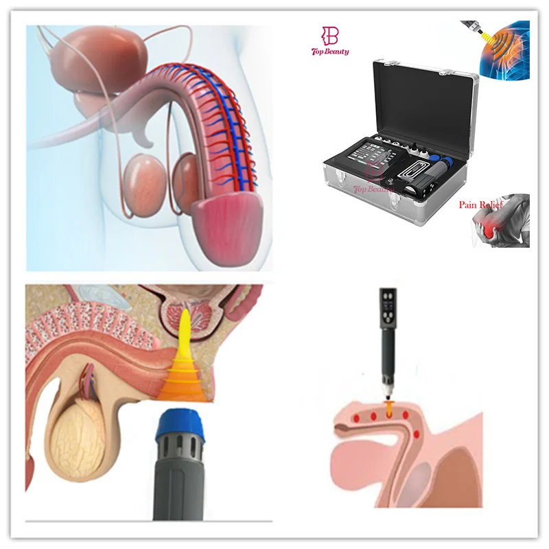 2 handle extracorporeal shock waves&pneumatic shockwave medical equipments for SW13 Erectile Dysfunction Treatment Device