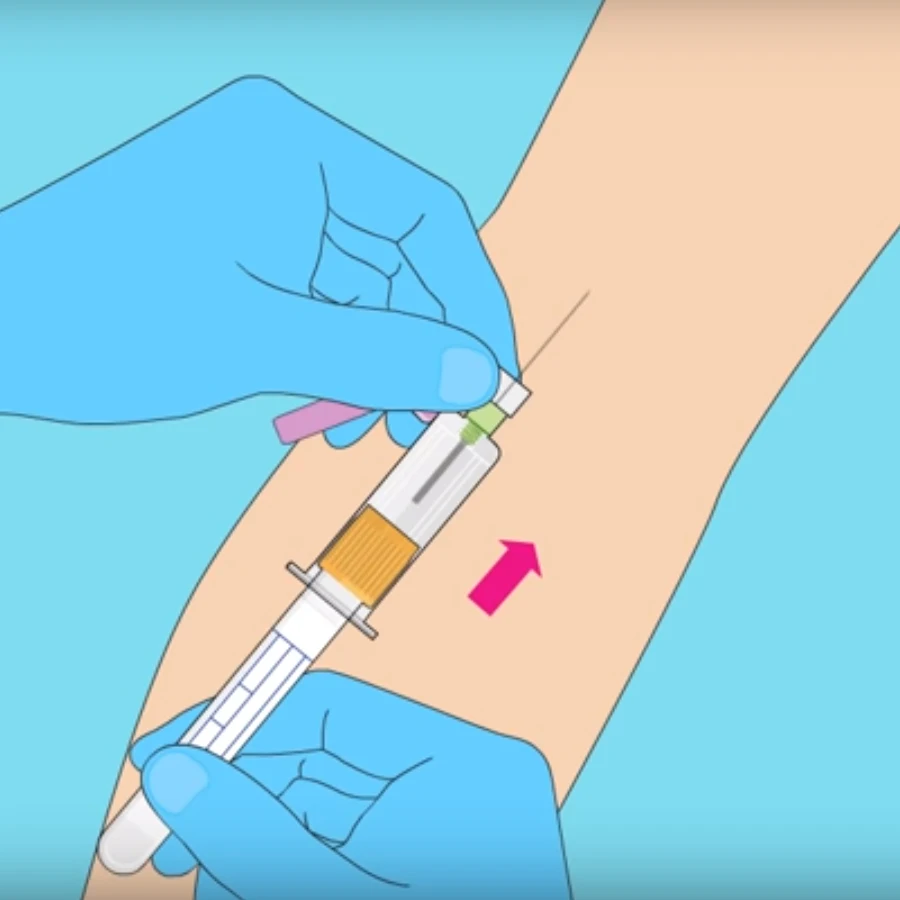 
BD Vacutainer Eclipse Blood Collection Needle 21 Gauge 1-1/4 368650 