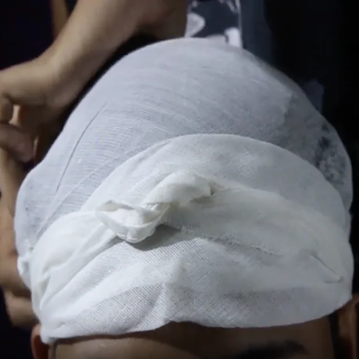 triangular bandage 3